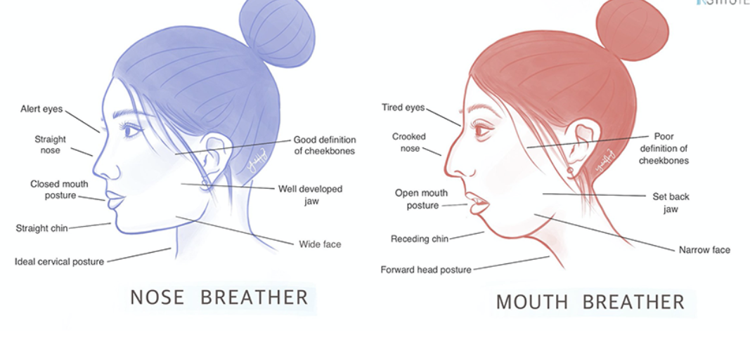 How Does Tongue Posture Affect Our Appearance And Health Luminous Face Yoga